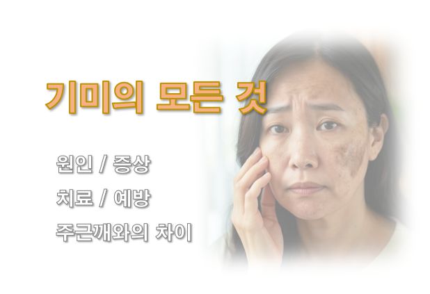 기미 원인, 증상, 종류, 치료, 예방 그리고 주근깨와 차이