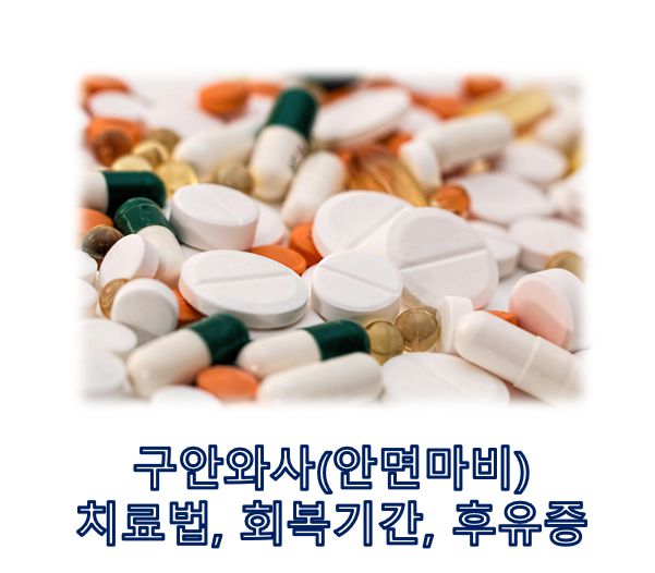 구안와사 안면마비 치료법 구안와사 회복기간 구안와사 후유증 관련 글 커버 사진