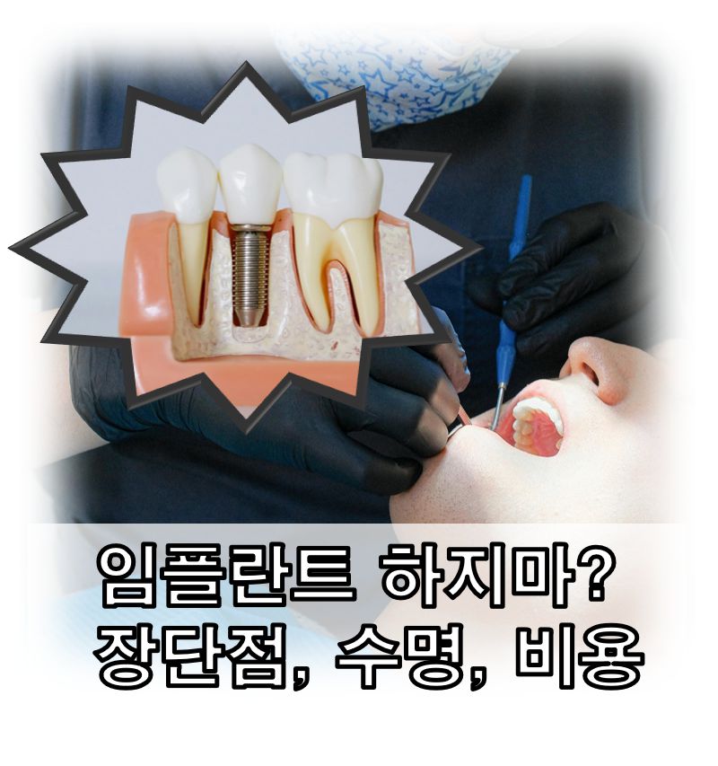 임플란트 하지마 임플란트 장점 임플란트 단점 임플란트 수명 임플란트 비용 정보글 커버 사진