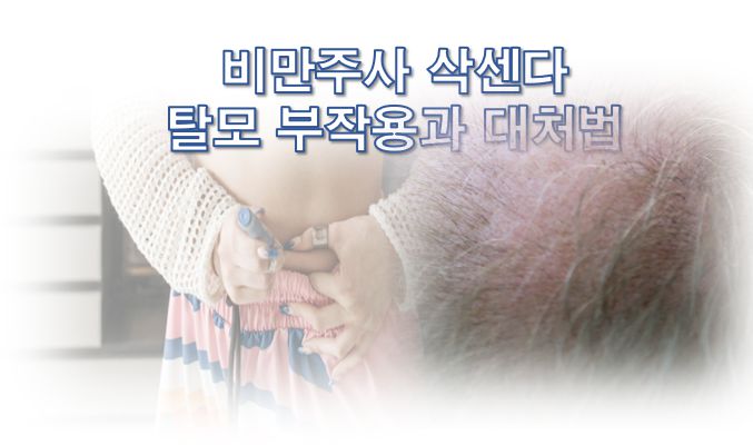 비만주사 삭센다 탈모 부작용
