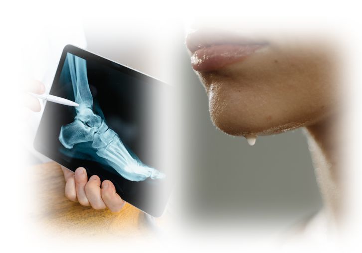 리비알 효눙 관련 사진 