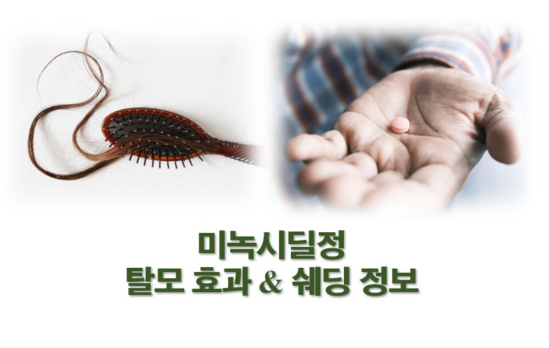 미녹시딜정 탈모 효과 쉐딩 정보