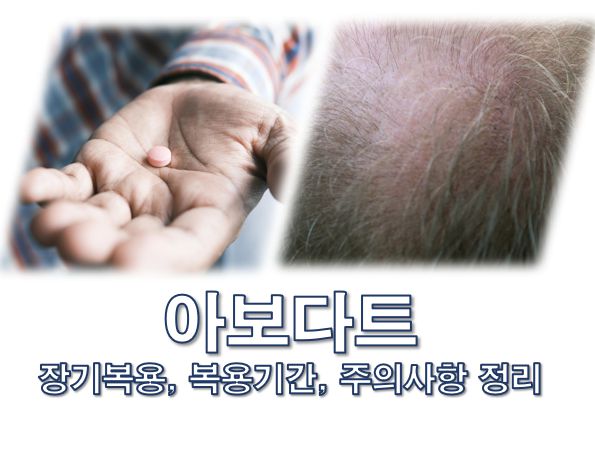 탈모약 아보다트 복용기간 장기복용 주의사항 정보 글 사진