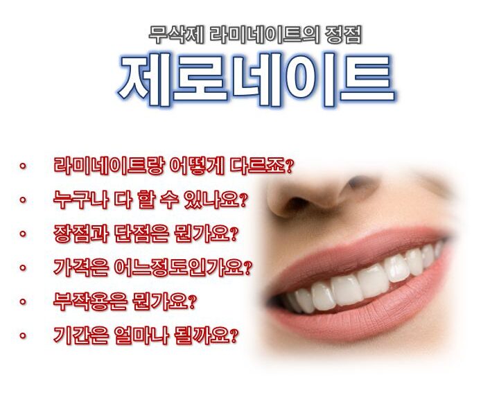 제로네이트 가격 부작용 장점 단점 기간 원리 정보 글 사진