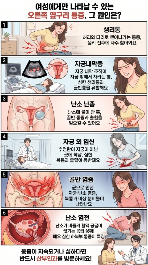 여성 오른쪽 옆구리 통증의 원인을 분석하는 웹툰으로 자궁내막증, 난소 난종, 자궁 외 임신, 골반 염증 등 질환들이 명시된 인포그래픽